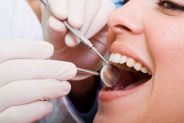 Cure dentali in Romania